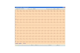 ASPEL ECG CARDIOTEKA v.211SOFT (Oprogramowanie)